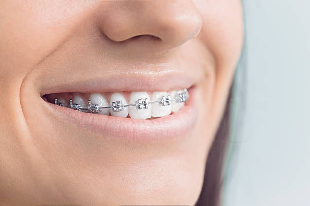 Best Teeth Whitening  in Lake Wynonah, PA